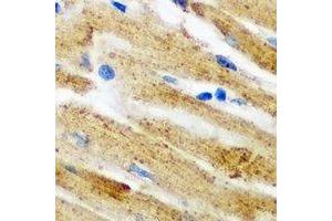 Immunohistochemical analysis of PICOT staining in mouse heart formalin fixed paraffin embedded tissue section. (GLRX3 antibody)