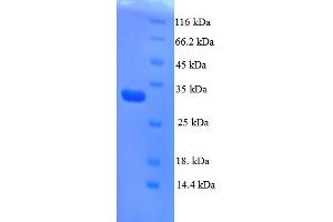 SDS-PAGE (SDS) image for Angiotensin II Receptor, Type 2 (AGTR2) (AA 1-45), (Extracellular) protein (GST tag) (ABIN5709011) (Angiotensin II Type 2 Receptor Protein (AA 1-45, Extracellular) (GST tag))