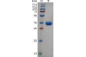 Gastrin-Releasing Peptide Protein (GRP) (AA 24-50) (Fc Tag)