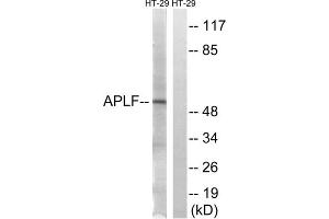 Immunohistochemistry analysis of paraffin-embedded human brain tissue, using APLF (epitope around residue 116) antibody. (APLF antibody  (Ser116))