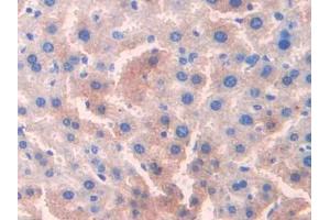 IHC-P analysis of Mouse Liver Tissue, with DAB staining. (OTC antibody  (AA 107-350))