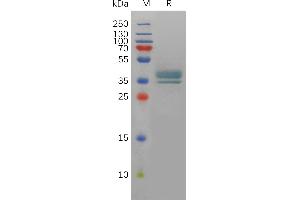 Human PT Protein, hFc Tag on SDS-PAGE under reducing condition. (PTGER2 Protein (AA 1-23) (Fc Tag))