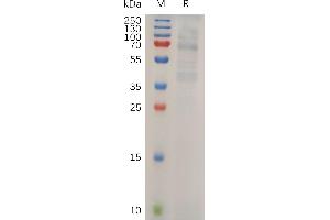 LIPG Protein (AA 21-500) (His tag)