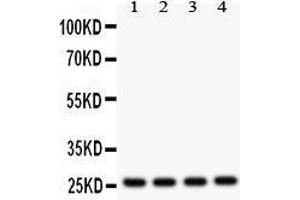 Western Blotting (WB) image for anti-Fms-Related tyrosine Kinase 3 Ligand (FLT3LG) (AA 79-110), (N-Term) antibody (ABIN3042394) (FLT3LG antibody  (N-Term))