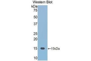 Western blot analysis of the recombinant protein. (FETUB antibody  (AA 152-261))