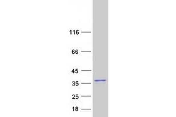 SUMF2 Protein (Transcript Variant 2) (Myc-DYKDDDDK Tag)