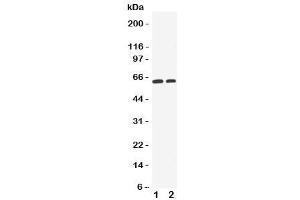 Western blot testing of OCT1 antibody and Lane 1:  HeLa (SLC22A1 antibody  (C-Term))