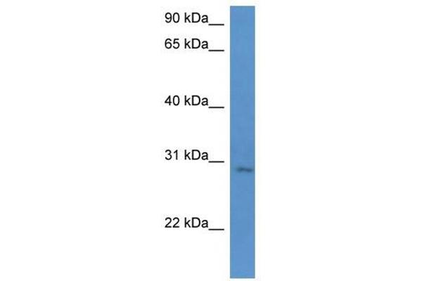 UTP23 antibody  (C-Term)