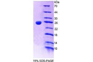 SDS-PAGE (SDS) image for Grancalcin, EF-Hand Calcium Binding Protein (GCA) (AA 39-220) protein (His tag) (ABIN6238771) (Grancalcin Protein (AA 39-220) (His tag))