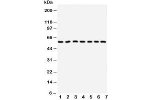 Western blot testing of CYP11B1 antibody and Lane 1:  HeLa;  2: U87;  3: MM231;  4: PANC;  5: MM453;  6: HeLa;  7: SMMC-7721 cell lysate. (CYP11B1 antibody  (C-Term))