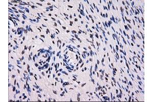 Immunohistochemical staining of paraffin-embedded Ovary tissue using anti-SORDmouse monoclonal antibody. (SORD antibody)