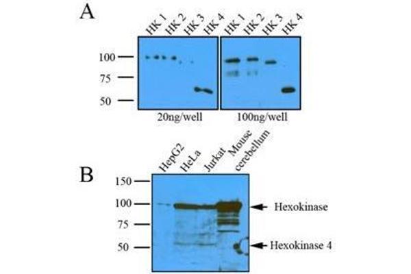 Hexokinase antibody  (AA 1-917)