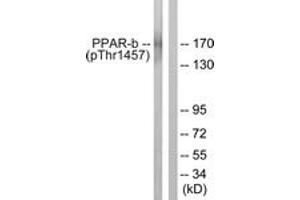 Western blot analysis of extracts from HuvEc cells treated with Serum 20% 30', using PPAR-BP (Phospho-Thr1457) Antibody. (PPAR-BP (AA 1423-1472), (pThr1457) antibody)