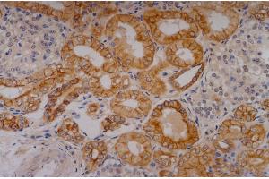 Immunohistochemistry (Paraffin-embedded Sections) (IHC (p)) image for anti-Keratin 18 (KRT18) antibody (ABIN94279)