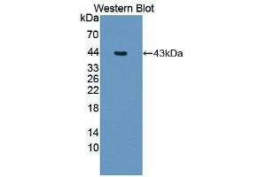 Western blot analysis of the recombinant protein. (MTR antibody  (AA 923-1265))