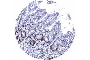 Duodenum mucosa (Recombinant SOX9 antibody  (AA 393-508))
