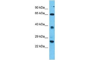 Western Blotting (WB) image for anti-Tetratricopeptide Repeat Domain 26 (TTC26) (N-Term) antibody (ABIN2791968) (TTC26 antibody  (N-Term))