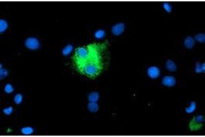 Image no. 3 for anti-Carboxypeptidase A1 (Pancreatic) (CPA1) antibody (ABIN1497592) (CPA1 antibody)