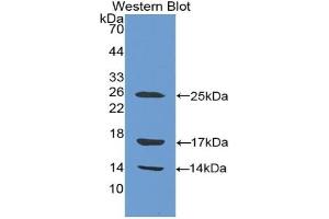Detection of Recombinant CAMP, Human using Polyclonal Antibody to Cathelicidin Antimicrobial Peptide (CAMP) (Cathelicidin antibody  (AA 31-170))