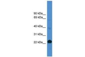 Image no. 1 for anti-CD8a Molecule (CD8A) (AA 61-110) antibody (ABIN6745481) (CD8 alpha antibody  (AA 61-110))