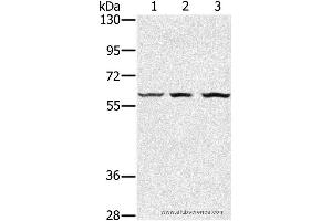 Western blot analysis of Human breast infiltrative duct tissue, Jurkat and HT-29 cell, using OXSR1 Polyclonal Antibody at dilution of 1:300 (OXSR1 antibody)