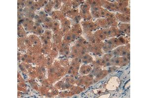 Used in DAB staining on fromalin fixed paraffin- embedded liver tissue (Transferrin Receptor 2 antibody  (AA 493-785))