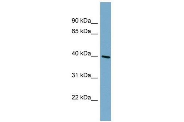 ST8SIA6 antibody  (Middle Region)