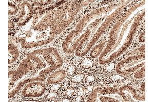 Immunohistochemistry analysis using Rabbit Anti-MCL 1 Polyclonal Antibody (ABIN5695933). (MCL-1 antibody  (AA 70-170) (FITC))