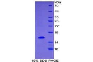 SDS-PAGE (SDS) image for CD70 Molecule (CD70) (AA 64-192) protein (His tag) (ABIN2122290) (CD70 Protein (AA 64-192) (His tag))