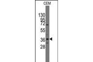 Western blot analysis of anti-Pilx2 Pab in CEM cell line lysates (35ug/lane). (PITX2 antibody  (AA 122-151))