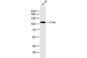 HL60 lysates probed with TLR4 Polyclonal Antibody, Unconjugated  at 1:300 dilution and 4˚C overnight incubation. (TLR4 antibody  (AA 431-530))