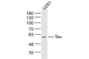 U251 lysates probed with Tau Polyclonal Antibody, Unconjugated  at 1:300 dilution and 4˚C overnight incubation. (tau antibody)