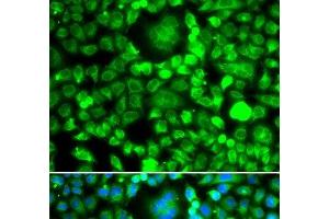 Immunofluorescence analysis of MCF-7 cells using BLID Polyclonal Antibody (BLID antibody)