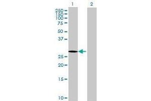 Lane 1: LRRC61 transfected lysate ( 28. (LRRC61 293T Cell Transient Overexpression Lysate(Denatured))