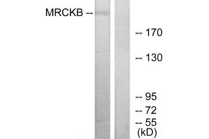 Western Blotting (WB) image for anti-CDC42 Binding Protein Kinase beta (DMPK-Like) (CDC42BPB) (C-Term) antibody (ABIN1850128) (CDC42BPB antibody  (C-Term))