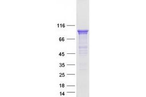 SSH3 Protein (Myc-DYKDDDDK Tag)