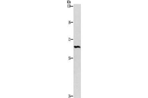 Western Blotting (WB) image for anti-Ceramide Kinase-Like (CERKL) antibody (ABIN2432841) (CERKL antibody)