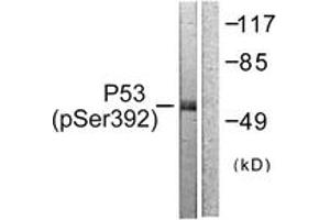 Western blot analysis of extracts from 293 cells treated with Etoposide 25uM 60', using p53 (Phospho-Ser392) Antibody. (p53 antibody  (pSer392))