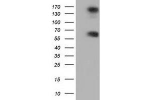 HEK293T cells were transfected with the pCMV6-ENTRY control (Left lane) or pCMV6-ENTRY BTN1A1 (Right lane) cDNA for 48 hrs and lysed. (BTN1A1 antibody)