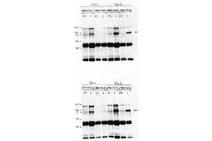 Image no. 1 for anti-Vav 2 Guanine Nucleotide Exchange Factor (VAV2) antibody (ABIN264962) (VAV2 antibody)