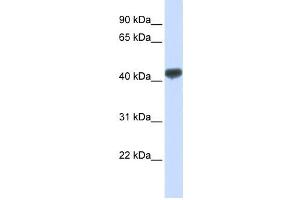 Western Blotting (WB) image for anti-Zinc Finger Protein 265 (Zranb2) antibody (ABIN2458270) (ZNF265 antibody)