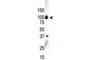 Western blot analysis of PKC nu antibody and NCI-H460 cell lysate (PRKD3 antibody  (AA 860-890))