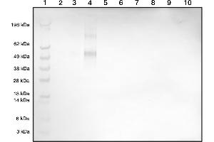 Western blot demonstrating our polyclonal detecting Histamine-BSA conjugate at 1in2000 dilution (1 = Marker, 2 = Histamine-BSA (1 ng), 3 = Histamine-BSA (5 ng), 4 = Histamine-BSA (10 ng), 5 =Blank, 6 = BSA (1 ng), 7 = BSA (5 ng), 8 = BSA (10 ng), 9 =Blank, 10 = Blank) (Histamine antibody)