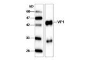 Image no. 1 for anti-Hepatitis A Virus VP1 (HAV VP1) (AA 7-143) antibody (ABIN791617) (HAV VP1 antibody  (AA 7-143))