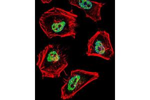 Immunofluorescence (IF) image for anti-Nuclear Receptor Co-Repressor 1 (NCOR1) antibody (ABIN2996086) (NCOR1 antibody)