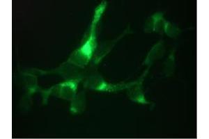 Immunofluorescent staining of LNCaP cells. (Prostate Specific Antigen antibody)