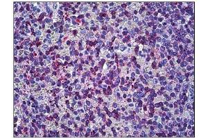 Human Prostate: Formalin-Fixed, Paraffin-Embedded (FFPE) (Matrix Metallopeptidase 23 (MMP23) (C-Term) antibody)