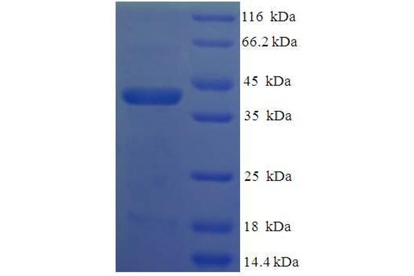 VTI1B Protein (AA 7-208, Cytoplasmic Domain, Cytosolic) (His-SUMO Tag)