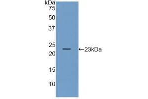 Figure. (CD79a antibody  (AA 30-193))