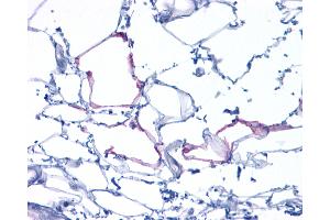 Anti-GCGR / Glucagon Receptor antibody IHC of human Adipose, Liposarcoma. (Glucagon Receptor antibody  (N-Term))